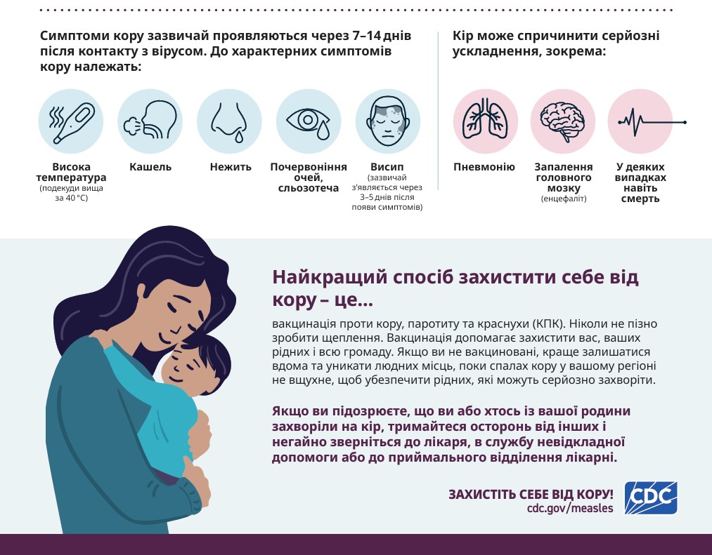 Важливо! Спалах кору в Каліфорнії: пам'ятка щодо симптомів та захисту!